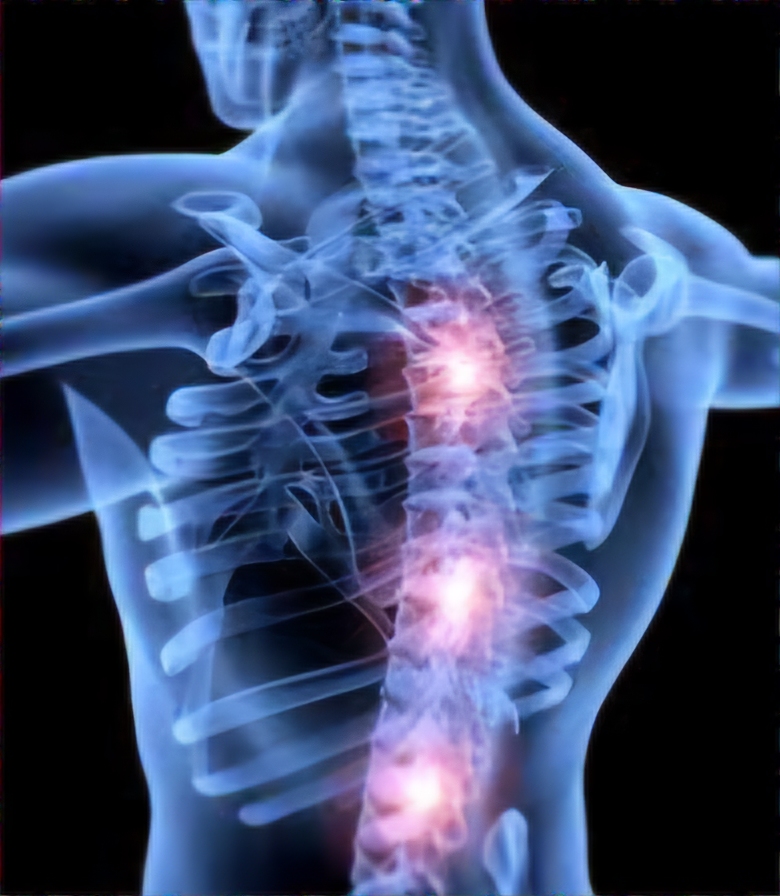 Image of bone density in a spine